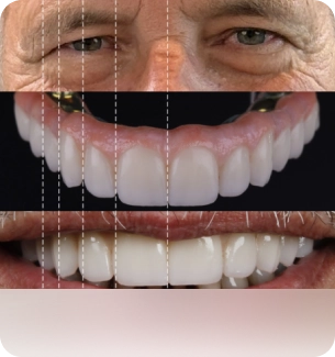 Digital Smile Design smile lines - Bauer Dental Center